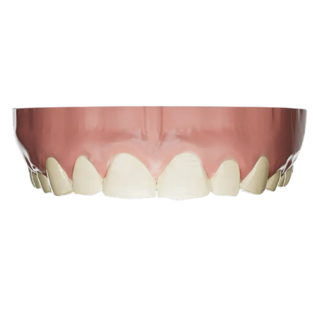 Résultat final après la taille des dents