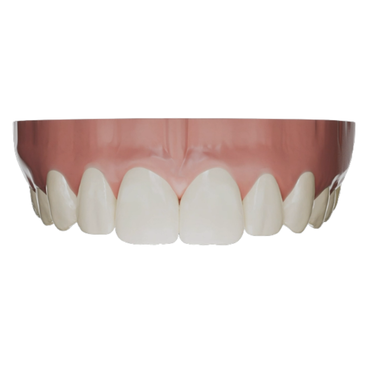 Préparation numérique de votre sourire grâce au logiciel FirstFit