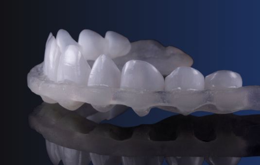 Guide OneStep FirstFit Ce guide vous permet de positionner vos facettes à l’intérieur et d’en poser 10 d’un seul geste !